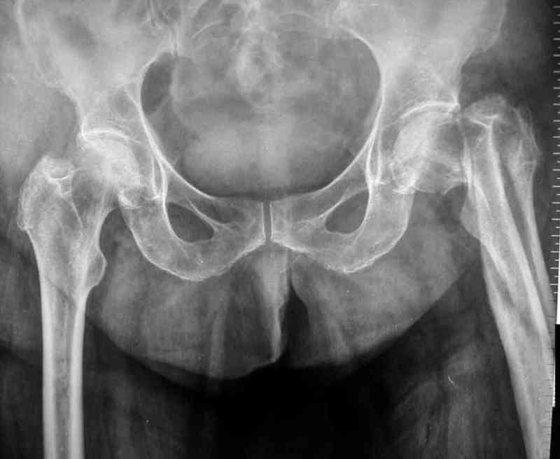 Busco radiografías usadas cualquier cantidad