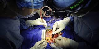 donación urgente de efectivo